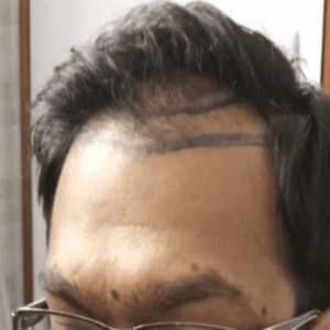 Renaissance Derma Clinic, Wakad