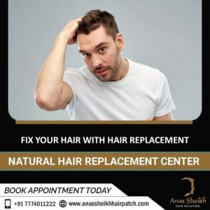 permanent Hair Patch solutions in Hinjewadi