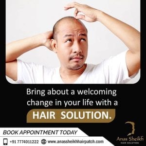 Anassheikh-Parmanent-hair-patch-Solution