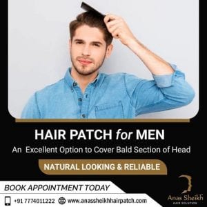 paermanent Hair Patch solutions in wakad