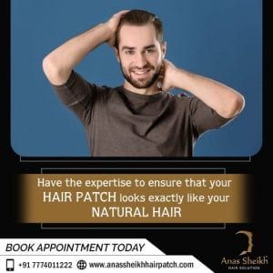 paermanent Hair Patch solutions in wakad