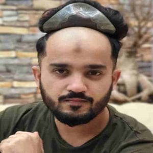 Anassheikh-Parmanent-hair-patch-Solution in wakad